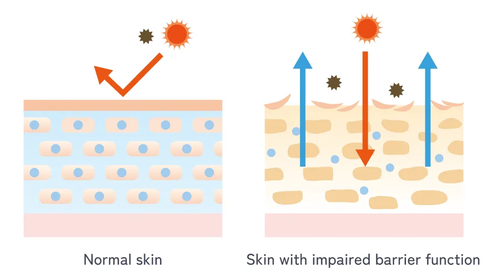 Normal skin Skin with impaired barrierd function