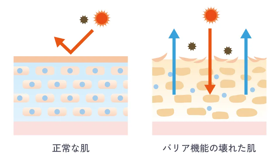 正常な肌とバリア機能の壊れた肌の概要図